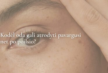 Kodėl oda gali atrodyti pavargusi net po poilsio?