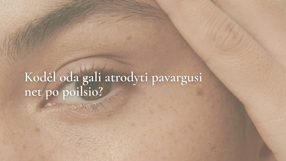 Kodėl oda gali atrodyti pavargusi net po poilsio?