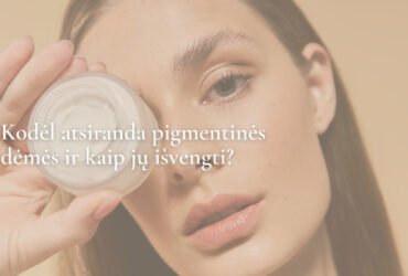 Kodėl atsiranda pigmentinės dėmės ir kaip jų išvengti?